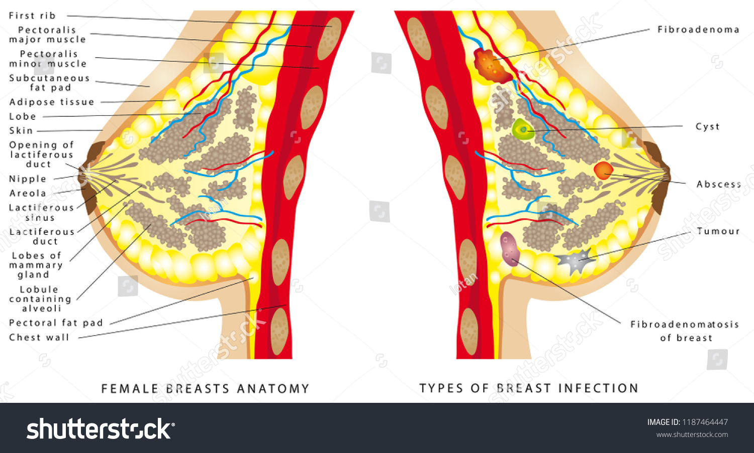 Breast Expansion Itch Io Breast Expansion Itch Io
